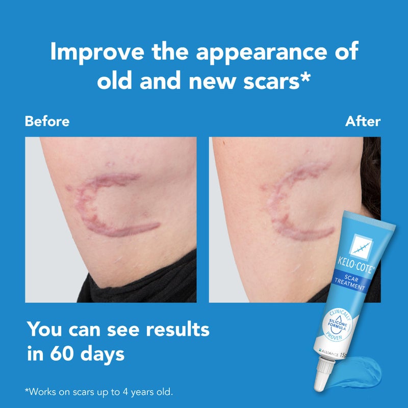 Kelo-Cote Gel for Scars 6g by Kelo-Cote - Image 2